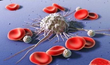 از هر ۶ نفر در جهان یکی به سرطان مبتلا است