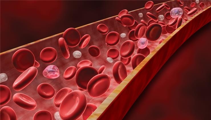 چگونه بدون آزمایش بفهمیم کم خونی داریم؟