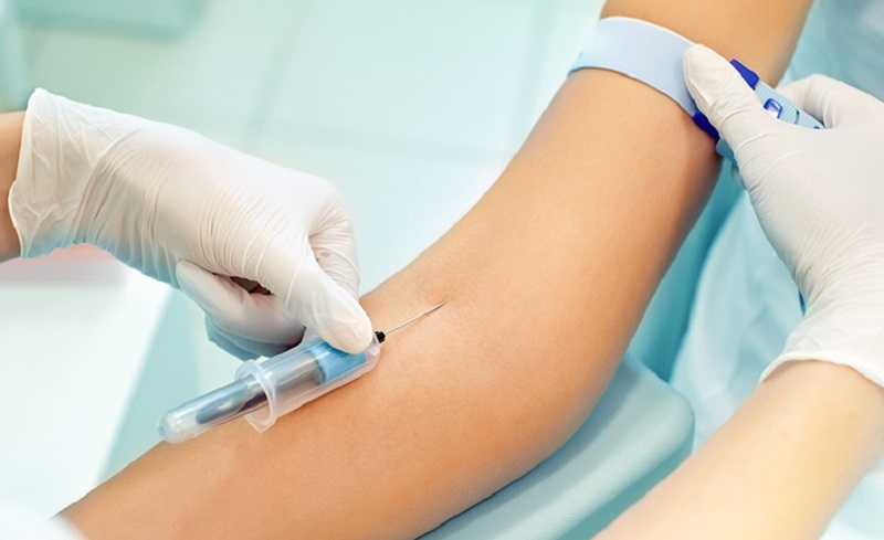 عواملی که روی نتایج آزمایش خون تاثیر می گذارند