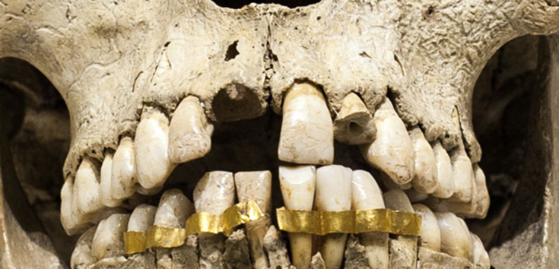 سیم کشی دندان مردگان در مصر باستان+ عکس
