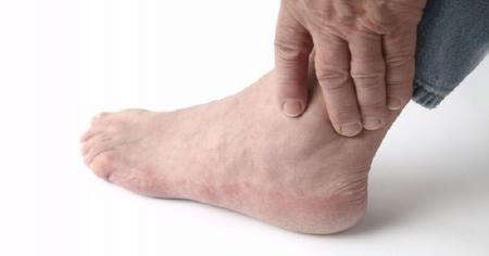 با تیرگی قوزک پا چه کنیم؟