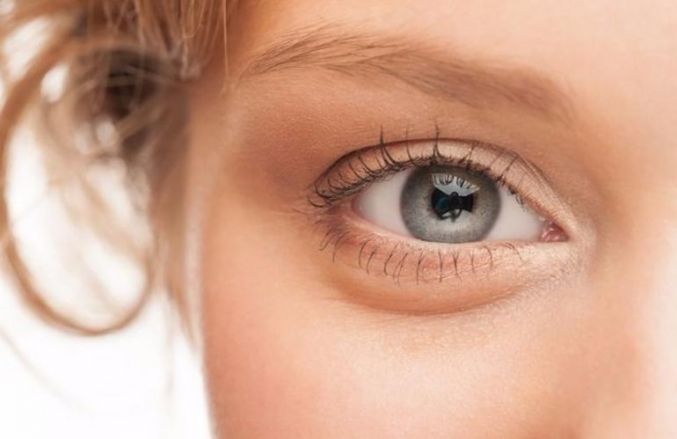  پف زیر چشم نشانه چه بیماری است؟ 