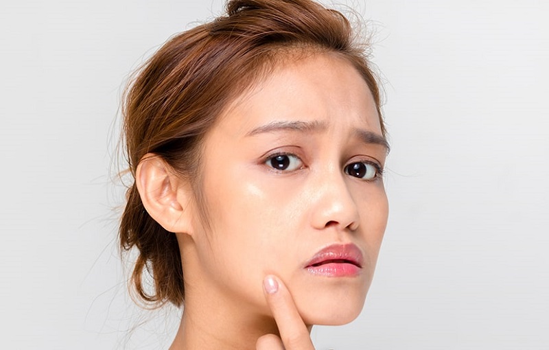 جای جوش و آکنه چگونه از بین می رود ؟