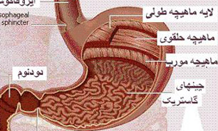 عرق گیاهی مخصوص پاکسازی معده