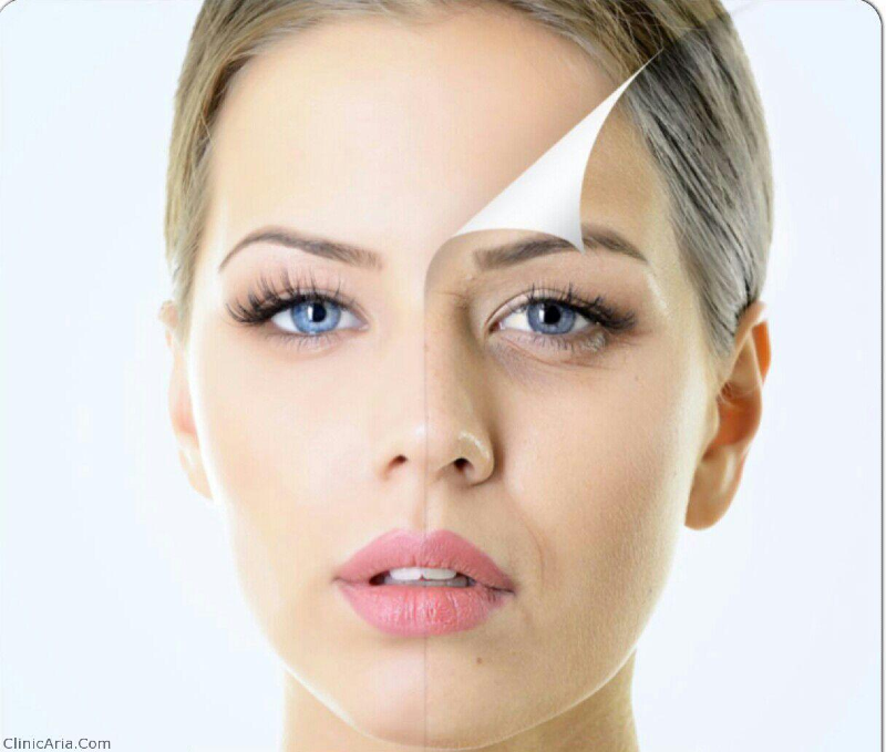 هر آنچه که  باید درباره لایه برداری پوست بدانید