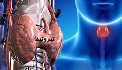 درمان‌های گیاهی و فوق موثر کم‌کاری تیرویید + راه‌های پیشگیری
