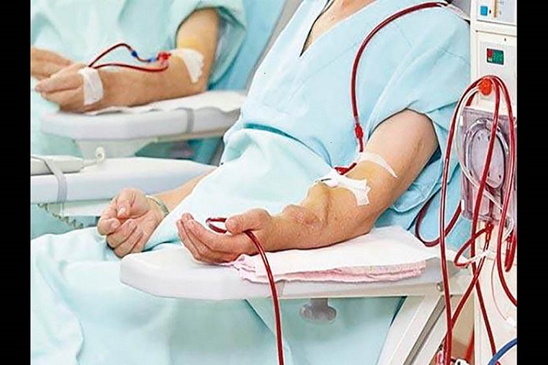 جدیدترین روش درمان بیماری مزمن کلیه