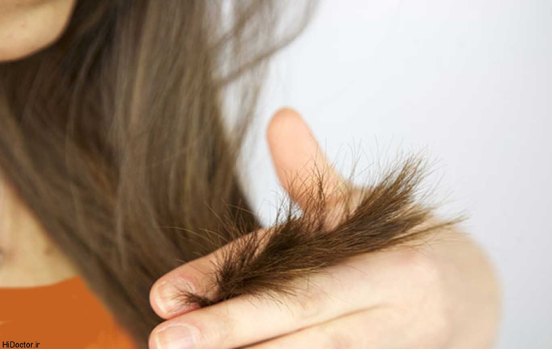 14اشتباهی که باعث موخوره موهایتان می‌شوند