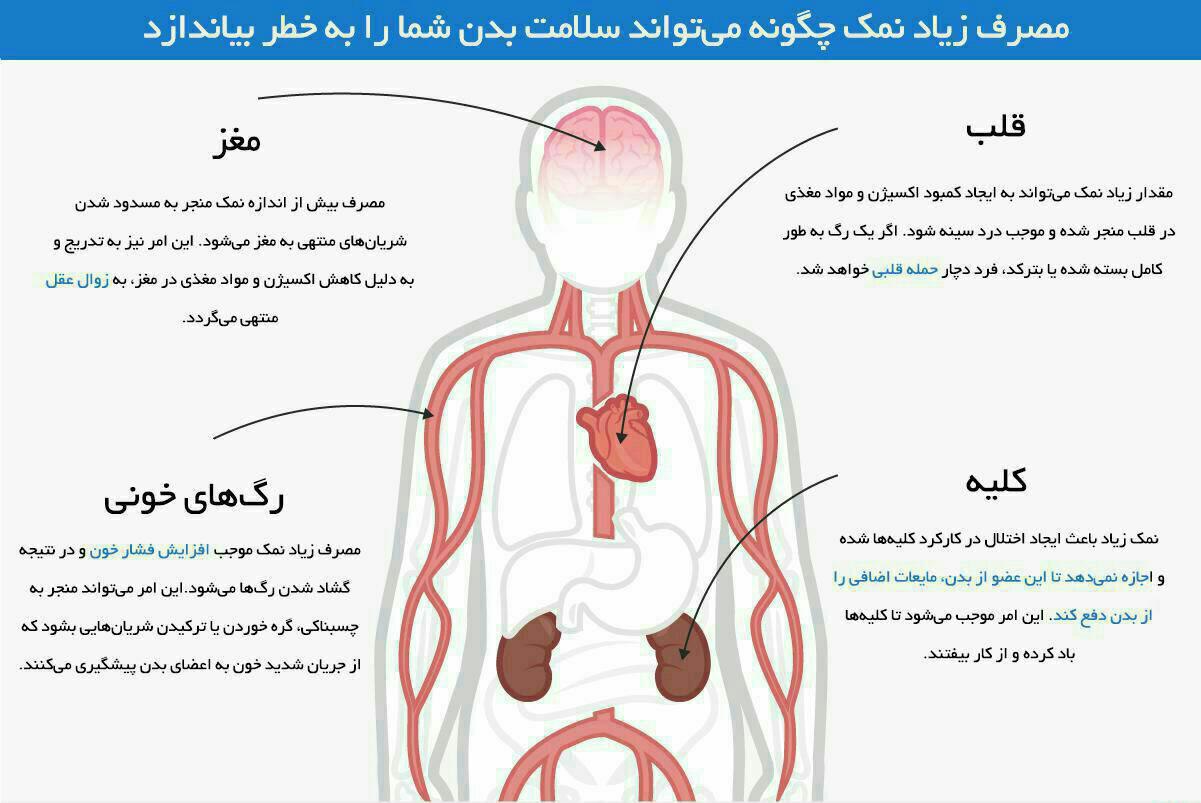 اینفوگرافیک/مصرف زیاد نمک چگونه سلامتی را به خطر می اندازد؟