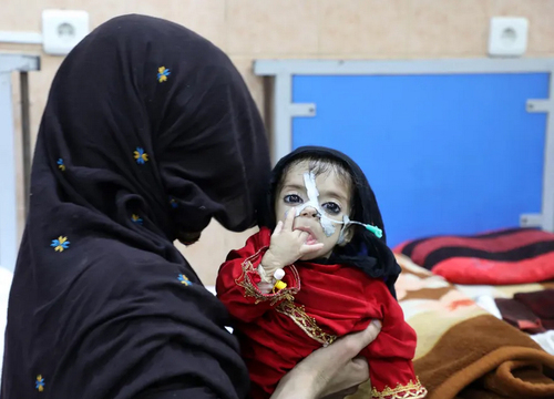 کودکی دچار سوء تغذیه در بیمارستان کابل + عکس - تلگرام آپ