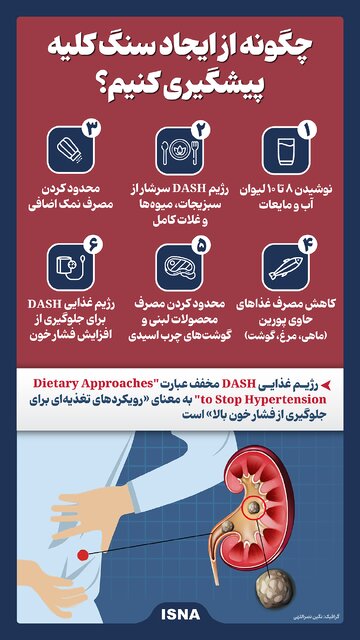 راهکارهای ساده برای پیشگیری از سنگ کلیه