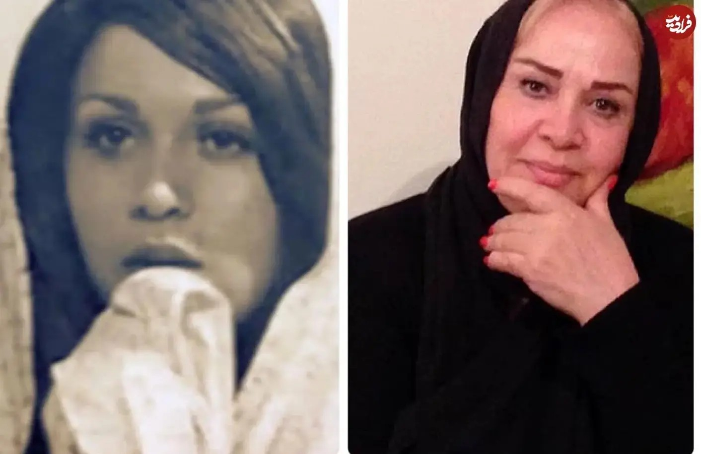 چهره «پریچهر پاکان» بازیگر قبل انقلاب بعد نیم قرن